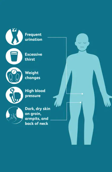 fish, humans, nostrils, organs, water, smell