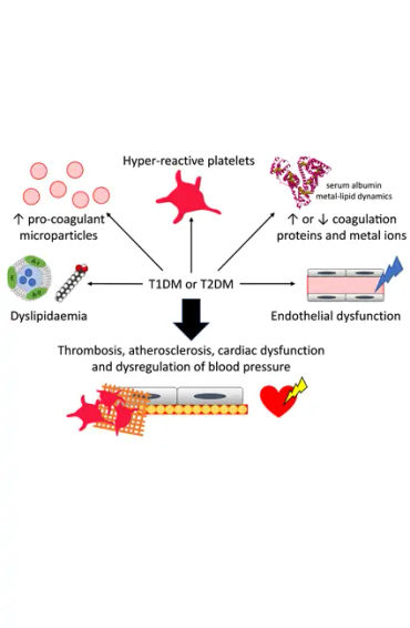 type 2 diabetes,  insulin, resistance, American Diabetes Association, strenuous exercise, weight red