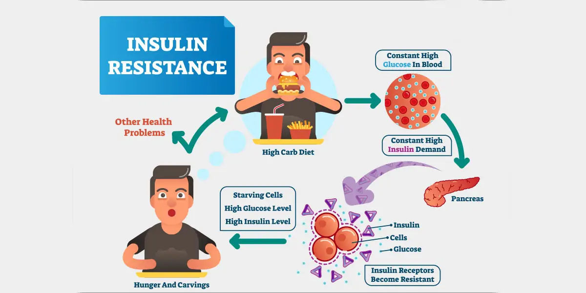 type 2 diabetes, insulin, resistance, American Diabetes Association, strenuous exercise, weight red