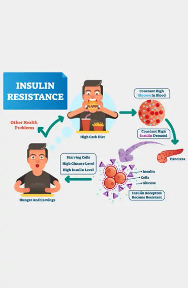 type 2 diabetes,  insulin, resistance, American Diabetes Association, strenuous exercise, weight red