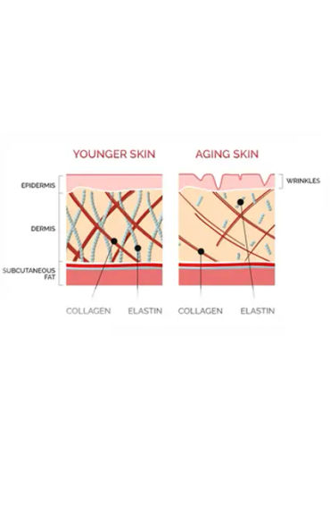 Collagen 