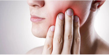 Wisdom teeth