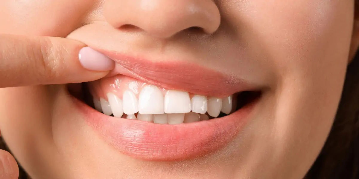 gums