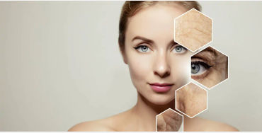 Collagen