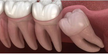  tooth