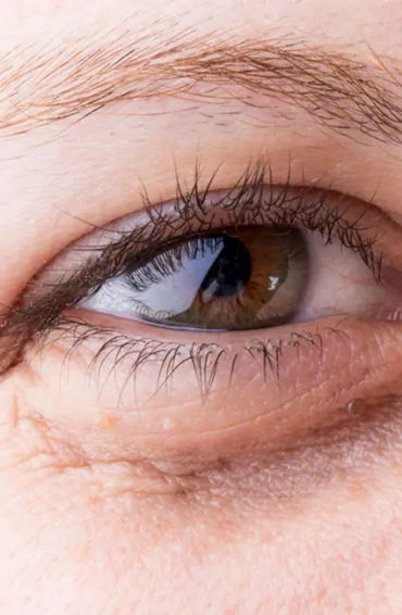 skin, exfoliate, dull skin, cells, rough skin