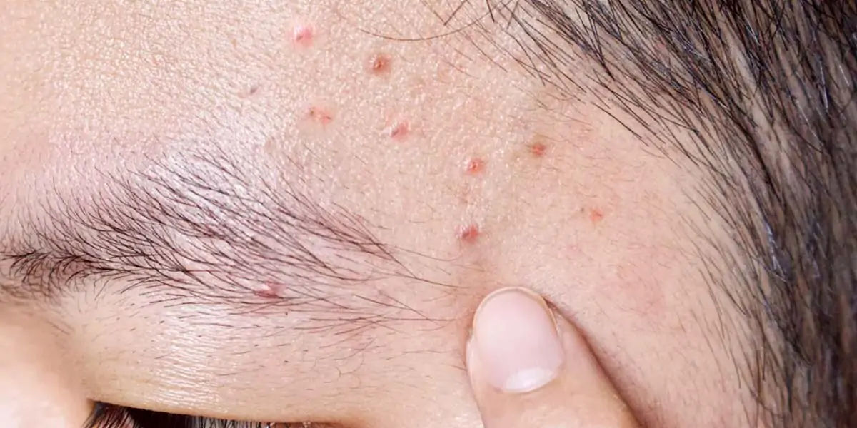 skin, exfoliate, dull skin, cells, rough skin