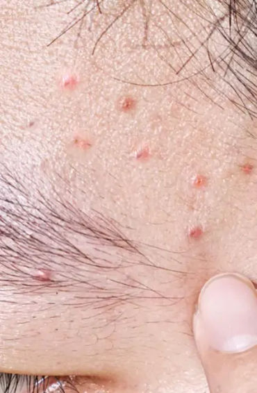 skin, exfoliate, dull skin, cells, rough skin