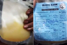 mausambi juice offered to dengue patient in prayagraj