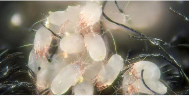 allergen