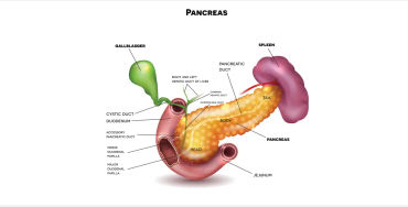 Pancreatic cancer