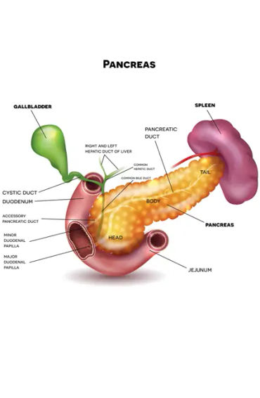 Pancreatic cancer
