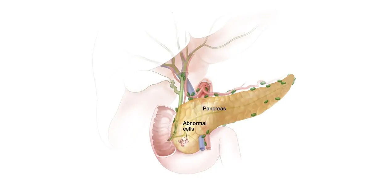 pancreas, digestion, Glucagon, insulin, exocrine, fat, protein, carbohydrates
