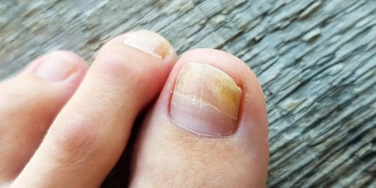 Fingernail