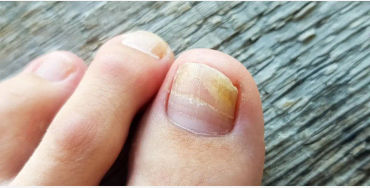 Fingernail