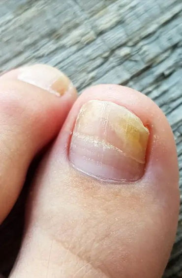 Fingernail