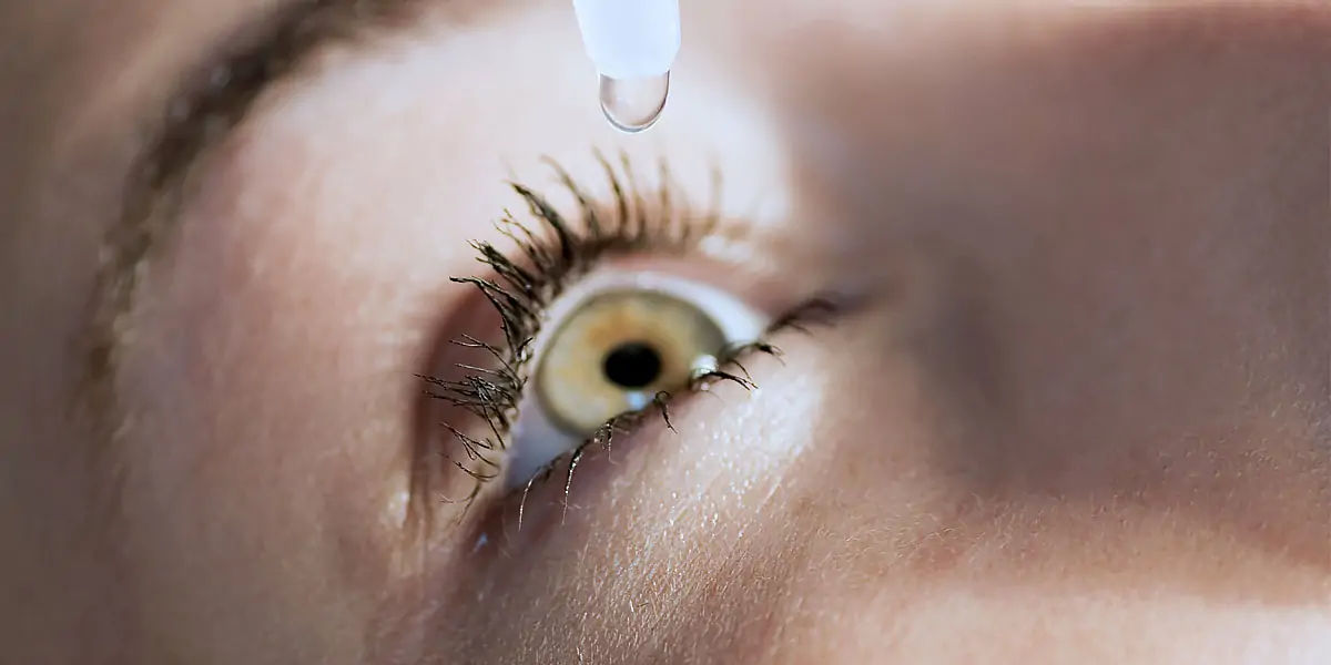 CATARACT