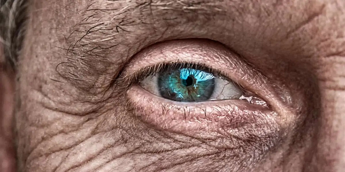 cataracts, eye, injury, operation