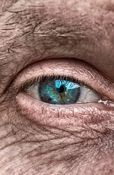 cataracts, eye, injury, operation