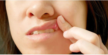 ulcers, bacteria, pain, infection