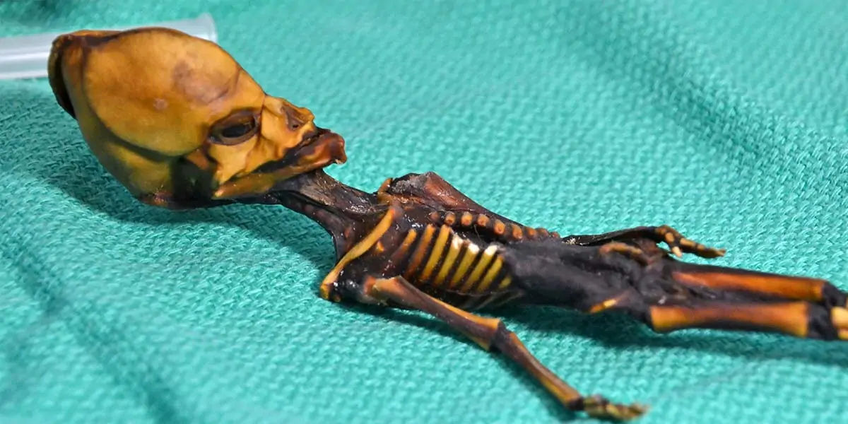 skeleton 