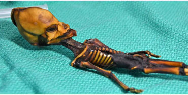 skeleton 