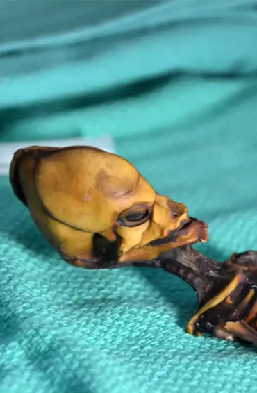skeleton 