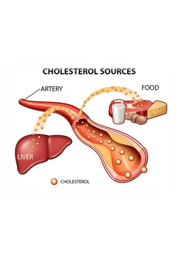 Cholesterol