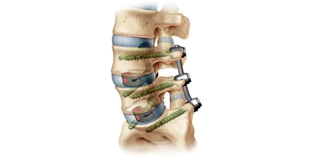 Spine, spinal cord