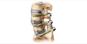 Spine, spinal cord