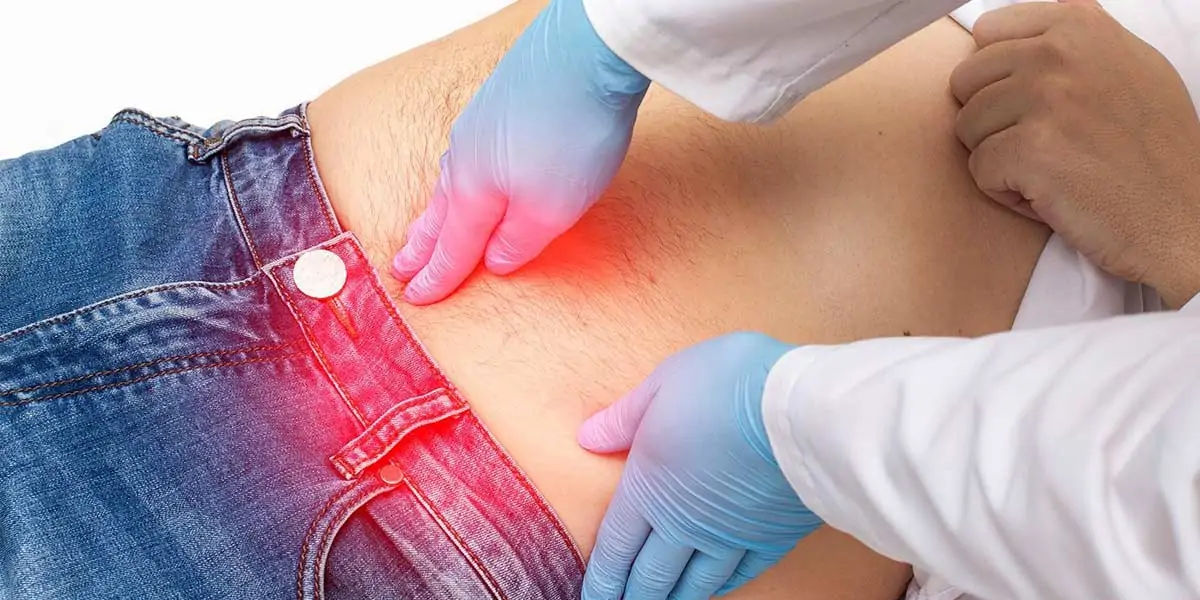 hernias, abdominal walls 