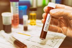 h3n2 influenza kills 2 in the country 3038 cases surfaced