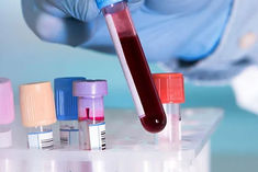 Indian startup develops AI-based blood test to detect 32 types of cancer