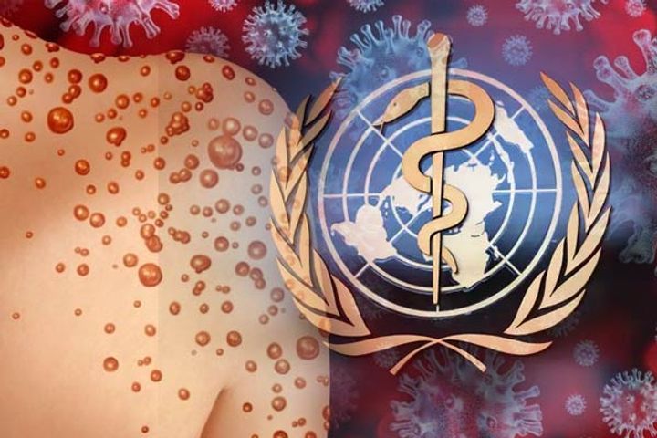 Monkeypox is no longer a global health emergency declares WHO